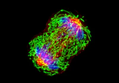 A colored microscopy image of a dividing breast cancer cell A colored microscopy image of a dividing breast cancer cell